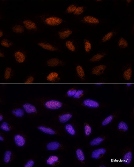 Western blot analysis of extracts of various cell lines using BAIAP2 Polyclonal Antibody at dilution of 1:1000.