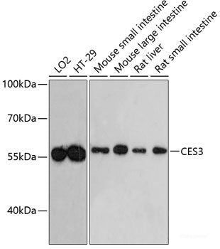 Western blot analysis of extracts of various cell lines using IL1RAP Polyclonal Antibody at dilution of 1:1000.
