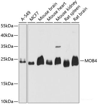 Western blot analysis of extracts of various cell lines using PSMD9 Polyclonal Antibody at dilution of 1:1000.