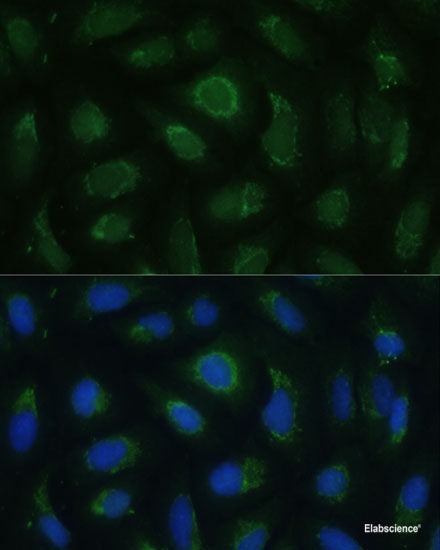 Western blot analysis of extracts of various cell lines using VAPB Polyclonal Antibody at dilution of 1:1000.