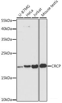 Western blot analysis of extracts of various cell lines using APTX Polyclonal Antibody at dilution of 1:1000.