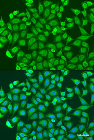 Western blot analysis of extracts of various cell lines using CYB5A Polyclonal Antibody at dilution of 1:1000.