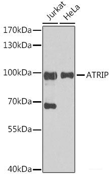 Western blot analysis of extracts of Mouse kidney using WNT7A Polyclonal Antibody.