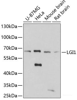 Western blot analysis of extracts of U-87MG cells using ROR2 Polyclonal Antibody at dilution of 1:1000.