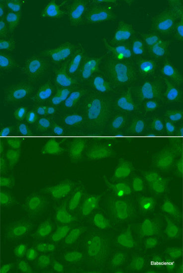 Western blot analysis of extracts of various cell lines using DDX3X Polyclonal Antibody at dilution of 1:1000.