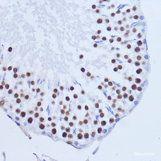 Immunohistochemistry of paraffin-embedded Rat brain using AKTIP Polyclonal Antibody at dilution of 1:100 (40x lens).