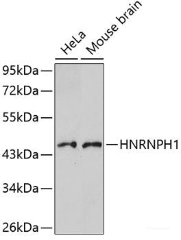 Western blot analysis of extracts of various cell lines using DNTT Polyclonal Antibody at dilution of 1:1000.