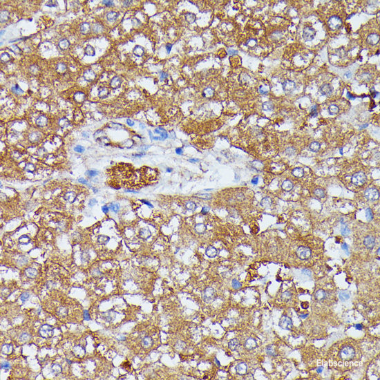 Immunohistochemistry of paraffin-embedded Rat brain using RARS Polyclonal Antibody at dilution of 1:100 (40x lens).