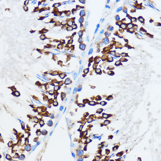 Immunofluorescence analysis of HeLa cells using ACY1 Polyclonal Antibody