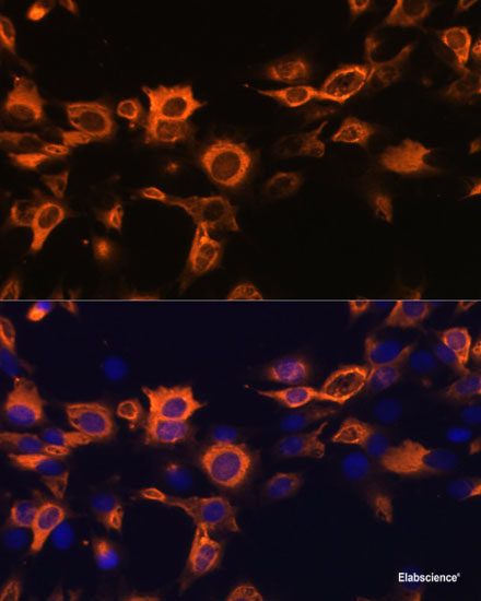 Immunohistochemistry of paraffin-embedded Rat kidney using ELF3 Polyclonal Antibody at dilution of 1:200 (40x lens).