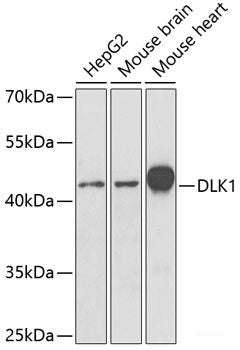 Immunofluorescence analysis of HeLa cells using SLC20A2 Polyclonal Antibody