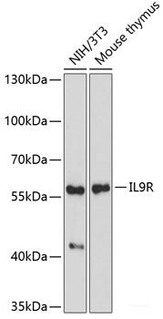 Immunohistochemistry of paraffin-embedded Human prostate using TSHB Polyclonal Antibody at dilution of 1:100 (40x lens).