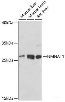 Immunofluorescence analysis of HeLa cells using NUDT2 Polyclonal Antibody