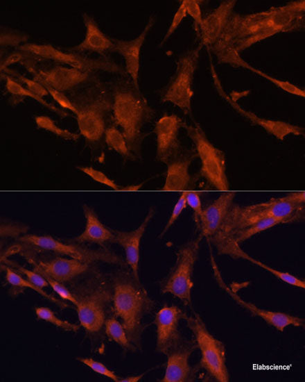 Immunofluorescence analysis of MCF7 cells using HABP2 Polyclonal Antibody
