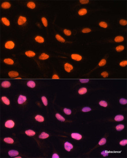 Immunohistochemistry of paraffin-embedded Human kidney cancer using TCEB3 Polyclonal Antibody at dilution of 1:100 (40x lens).