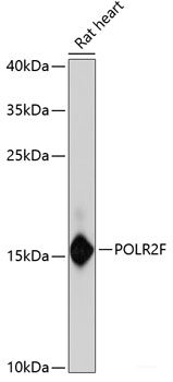 Immunofluorescence analysis of A-549 cells using DYRK2 Polyclonal Antibody