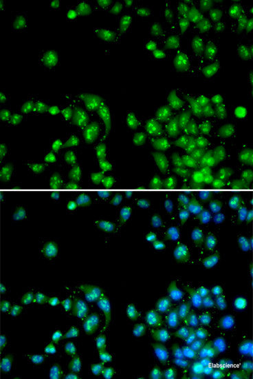 Immunohistochemistry of paraffin-embedded Mouse kidney using FKBP6 Polyclonal Antibody at dilution of 1:100 (40x lens).
