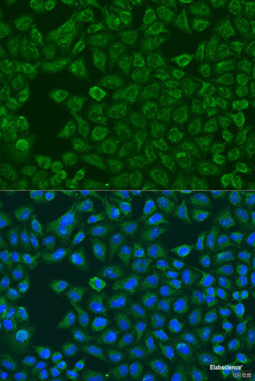 Immunohistochemistry of paraffin-embedded Rat lung using LRG1 Polyclonal Antibody at dilution of 1:100 (40x lens).