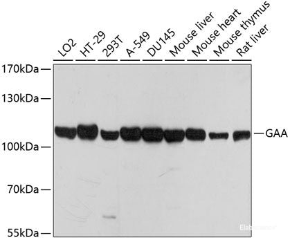 Western blot analysis of extracts of various cell lines using GLYCTK Polyclonal Antibody at dilution of 1:1000.