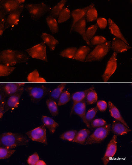 Immunofluorescence analysis of Rat retina using RDH5 Polyclonal Antibody at dilution of 1:100 (40x lens). Blue: DAPI for nuclear staining.