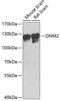 Immunohistochemistry of paraffin-embedded Human esophagus using ADH1C Polyclonal Antibody at dilution of 1:100 (40x lens).