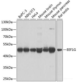 Immunohistochemistry of paraffin-embedded Rat kidney using NEDD4L Polyclonal Antibody at dilution of 1:200 (40x lens).