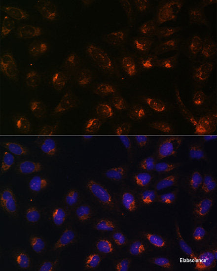 Western blot analysis of extracts of various cell lines using ATP5O Polyclonal Antibody at dilution of 1:1000.