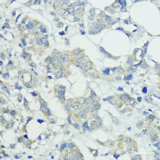 Immunofluorescence analysis of U2OS cells using STXBP3 Polyclonal Antibody at dilution of 1:100. Blue: DAPI for nuclear staining.