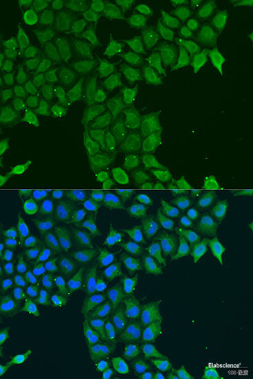 Immunohistochemistry of paraffin-embedded Rat heart using PITRM1 Polyclonal Antibody at dilution of 1:100 (40x lens).