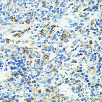 Immunohistochemistry of paraffin-embedded Rat kidney using ATP7A Polyclonal Antibody at dilution of 1:100 (40x lens).