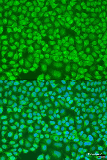 Western blot analysis of extracts of various cell lines using GNG10 Polyclonal Antibody at dilution of 1:1000.