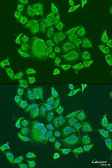 Immunohistochemistry of paraffin-embedded Human liver damage using UVRAG Polyclonal Antibody at dilution of 1:100 (40x lens).