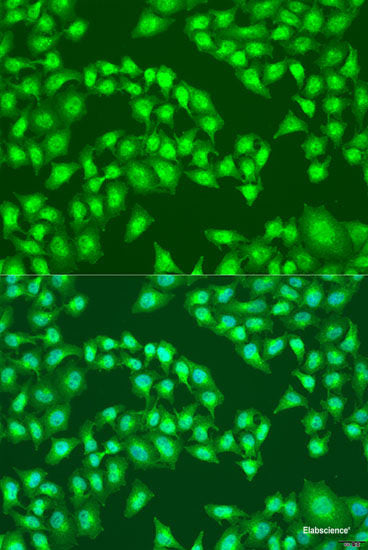 Western blot analysis of extracts of U-251MG cells using DOK2 Polyclonal Antibody at dilution of 1:1000.