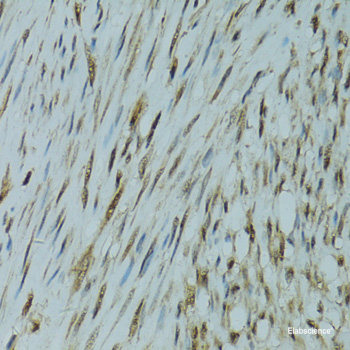 Immunohistochemistry of paraffin-embedded Human liver damage using KCNK9 Polyclonal Antibody at dilution of 1:100 (40x lens).