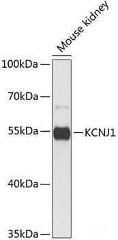 Western blot analysis of extracts of various cell lines using DDX56 Polyclonal Antibody at dilution of 1:3000.