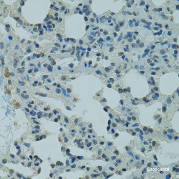 Western blot analysis of extracts of Mouse skeletal muscle using MYH6 Polyclonal Antibody.