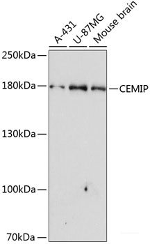 Immunofluorescence analysis of U2OS cells using HOXA2 Polyclonal Antibody at dilution of 1:100. Blue: DAPI for nuclear staining.