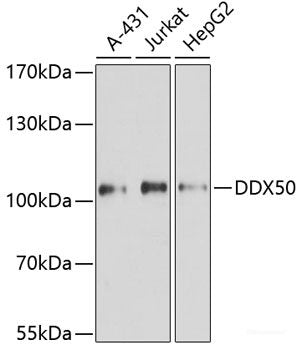 Western blot analysis of extracts of various cell lines using CALB2 Polyclonal Antibody at dilution of 1:1000.