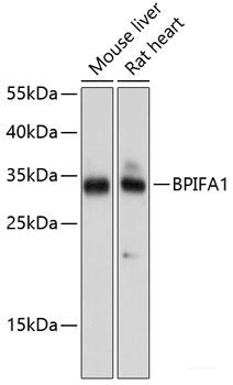 Immunohistochemistry of paraffin-embedded Rat testis using CTAG1B Polyclonal Antibody at dilution of 1:100 (40x lens).