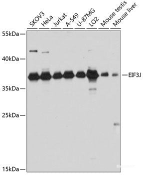 Western blot analysis of extracts of various cell lines using GIPR Polyclonal Antibody at dilution of 1:1000.