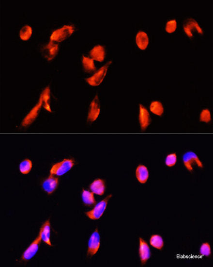 Western blot analysis of extracts of Mouse spleen using S100A9 Polyclonal Antibody at dilution of 1:1000.