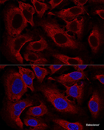 Western blot analysis of extracts of H460 cells using UQCRQ Polyclonal Antibody at dilution of 1:1000.