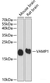Confocal immunofluorescence analysis of U2OS cells using MRPS16 Polyclonal Antibody at dilution of 1:100. Blue: DAPI for nuclear staining.