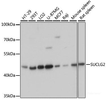 Immunohistochemistry of paraffin-embedded Human prostate using POMGNT1 Polyclonal Antibody at dilution of 1:100 (40x lens).