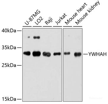 Immunohistochemistry of paraffin-embedded Mouse lung using HPR Polyclonal Antibody at dilution of 1:100 (40x lens).