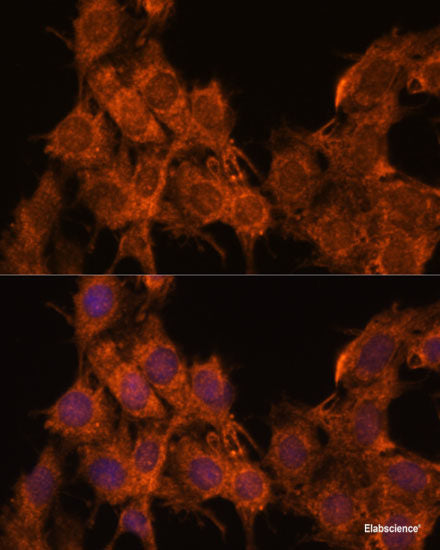Immunohistochemistry of paraffin-embedded Human liver using KIR3DS1 Polyclonal Antibody at dilution of 1:100 (40x lens).