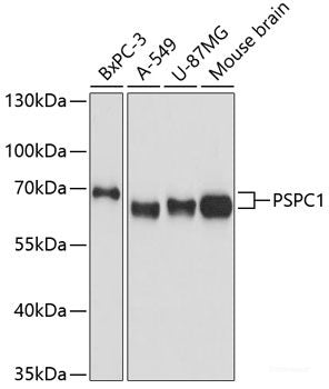 Immunofluorescence analysis of C6 cells using PDHA2 Polyclonal Antibody at dilution of 1:100 (40x lens). Blue: DAPI for nuclear staining.