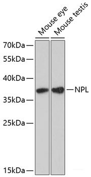 Western blot analysis of extracts of various cell lines using SERPINB6 Polyclonal Antibody at dilution of 1:1000.