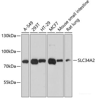 Immunohistochemistry of paraffin-embedded Rat spleen using UQCC2 Polyclonal Antibody at dilution of 1:100 (40x lens).