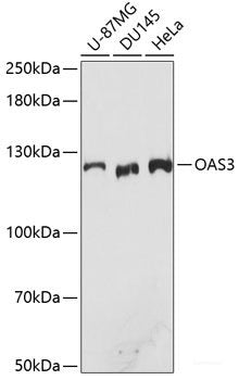 Immunohistochemistry of paraffin-embedded Human gastric cancer using SLC2A13 Polyclonal Antibody at dilution of 1:100 (40x lens).